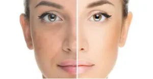 Tan-Free Radiance