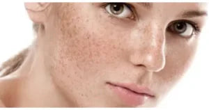 Spotless Glow Formula